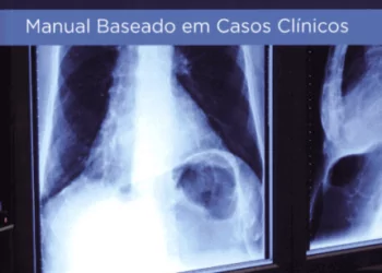 Talanow, Radiologia de Emergência - 1. ed. PDF