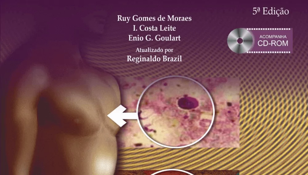 Moraes, Parasitologia e Micologia Humana - 5. ed. PDF