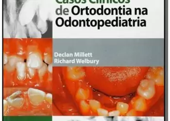Casos Clínicos de Ortodontia na Odontopediatria - 2. ed. PDF