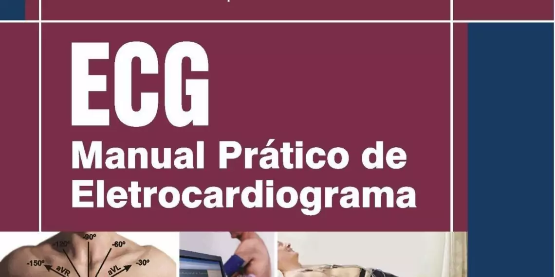 Manual Prático de Eletrocardiograma - 1. ed. PDF