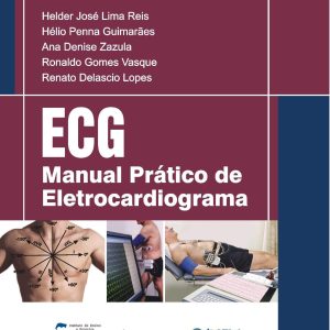 Manual Prático de Eletrocardiograma – 1. ed. PDF