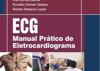 Manual Prático de Eletrocardiograma - 1. ed. PDF