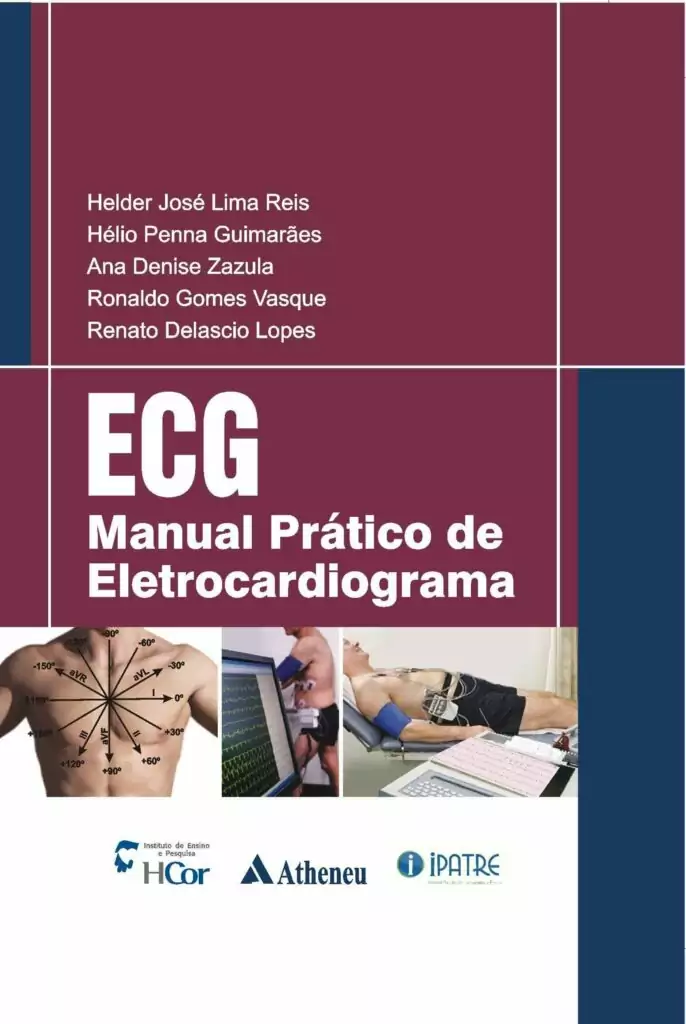 Manual Prático de Eletrocardiograma – 1. ed. PDF