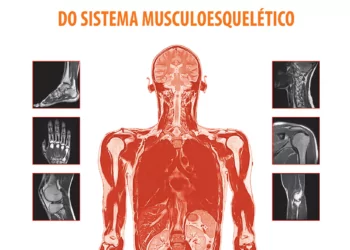 Atlas de ressonância magnética do sistema musculoesquelético - 2. ed. PDF