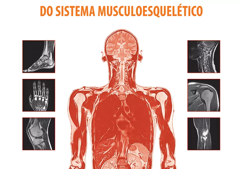 Atlas de ressonância magnética do sistema musculoesquelético - 2. ed. PDF