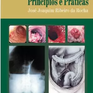 Coloproctologia, princípios e práticas (Rocha) – 1. ed. PDF