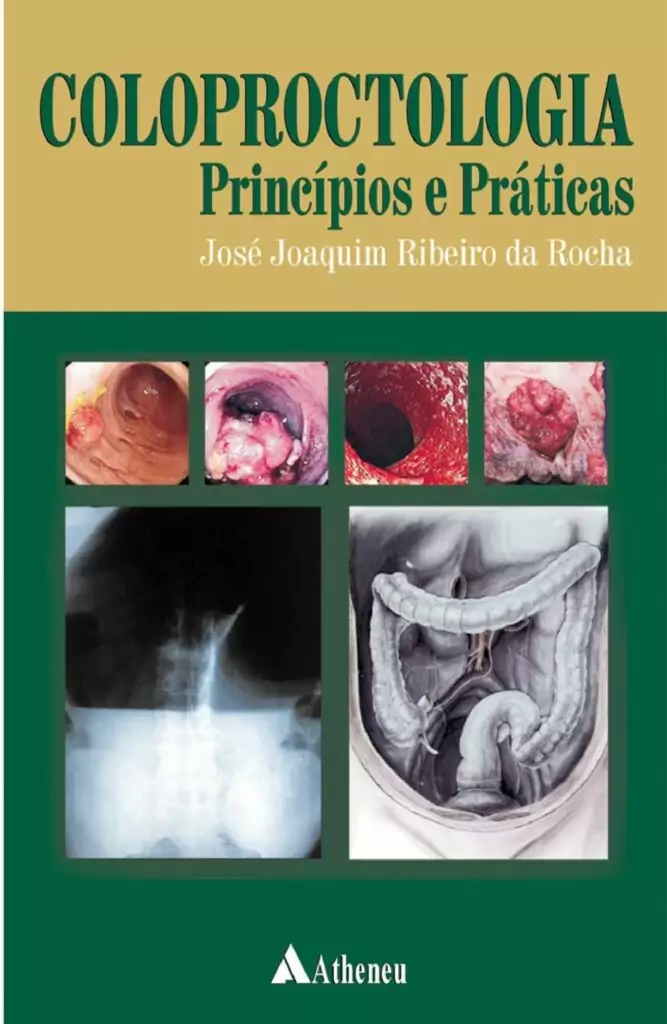 Coloproctologia, princípios e práticas (Rocha) – 1. ed. PDF