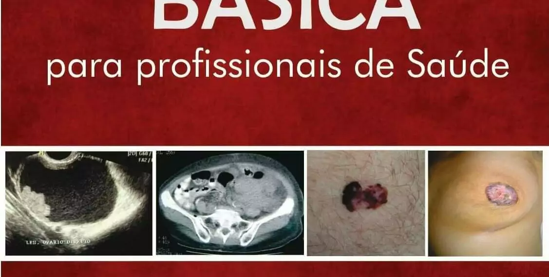 Oncologia básica para profissionais de saúde - 1. ed. PDF