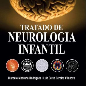 Tratado de neurologia infantil – 1. ed. PDF
