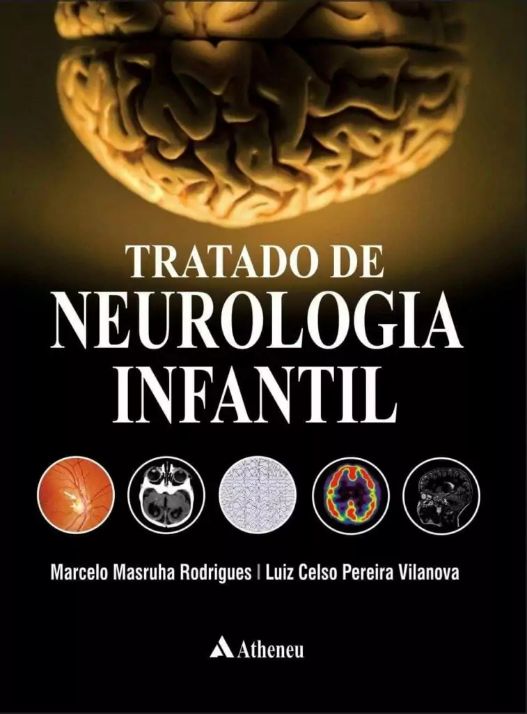 Tratado de neurologia infantil – 1. ed. PDF