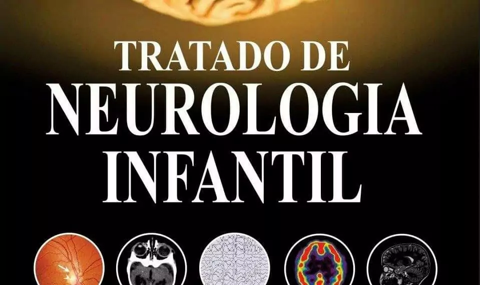 Tratado de neurologia infantil - 1. ed. PDF