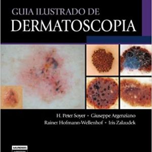 Guia ilustrado de Dermatoscopia (Soyer) – 2. ed. PDF