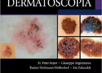 Guia ilustrado de Dermatoscopia (Soyer) - 2. ed. PDF