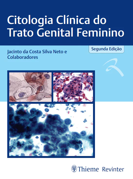 Citologia clínica do trato genital feminino – 2. ed. PDF