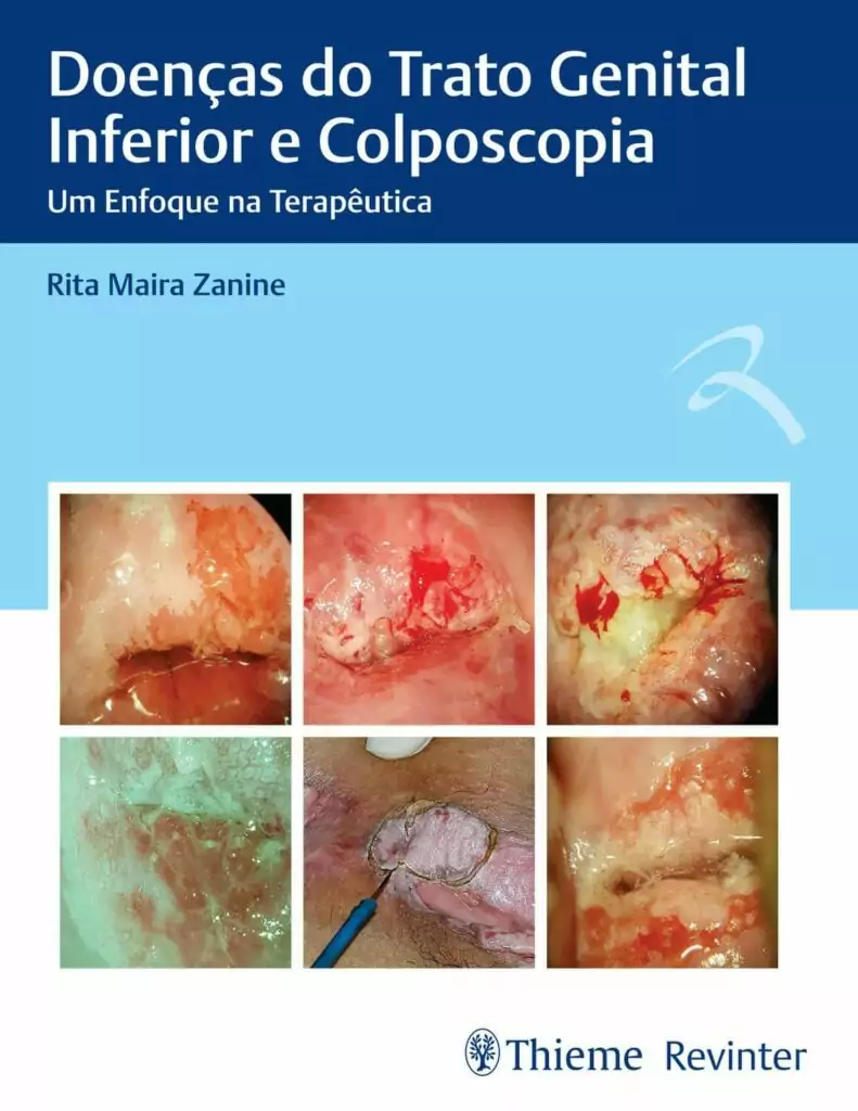 Doenças do Trato Genital Inferior e Colposcopia – 1. ed. PDF