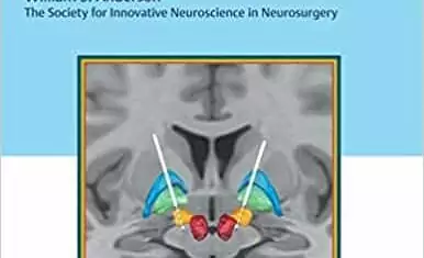 Estimulação cerebral profunda: técnicas e práticas – 1. ed. PDF