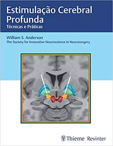 Estimulação cerebral profunda: técnicas e práticas - 1. ed. PDF