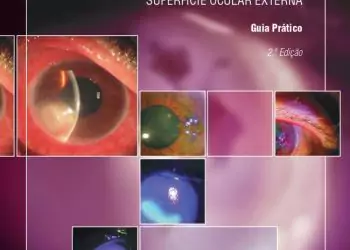 Antibioterapia na Superfície Ocular: guia prático - 2. ed. PDF