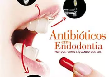 Antibióticos em endodontia: por que, como e quando usá-los - 1. ed. PDF