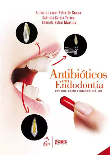 Antibióticos em endodontia: por que, como e quando usá-los - 1. ed. PDF