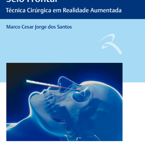 Cirurgia endoscópica do seio frontal: técnica cirúrgica em realidade aumentada – 1. ed. PDF