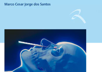 Cirurgia endoscópica do seio frontal: técnica cirúrgica em realidade aumentada - 1. ed. PDF