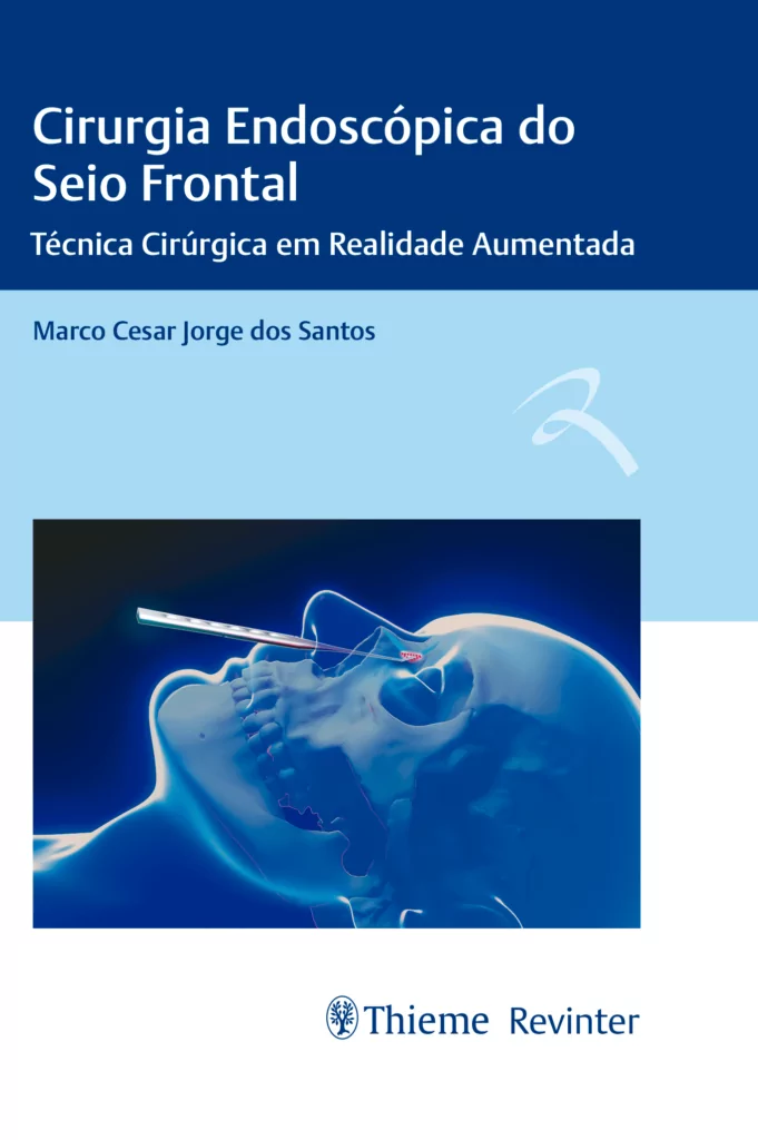 Cirurgia endoscópica do seio frontal: técnica cirúrgica em realidade aumentada – 1. ed. PDF
