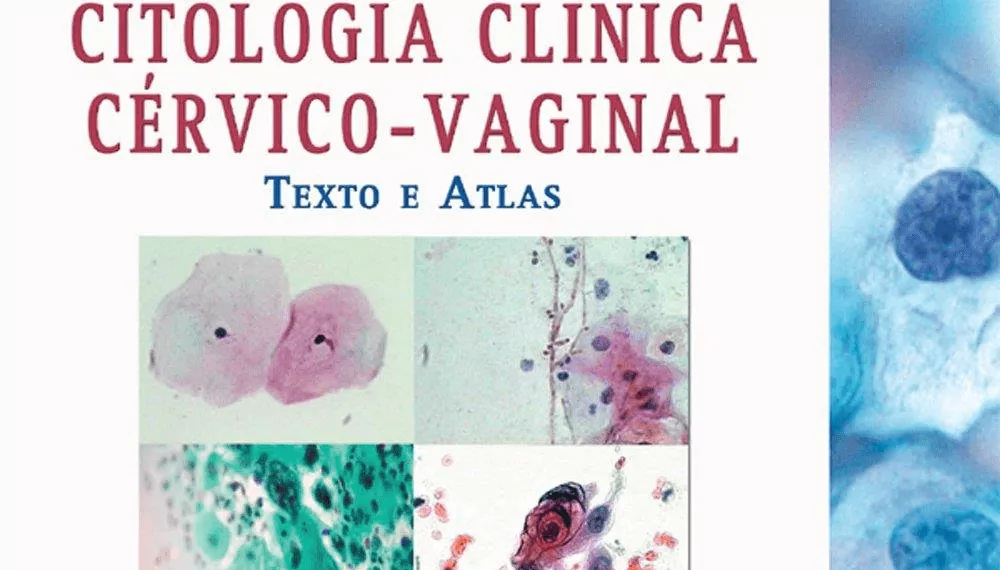 Citologia clínica cérvico-vaginal: texto e atlas - 1. ed. PDF