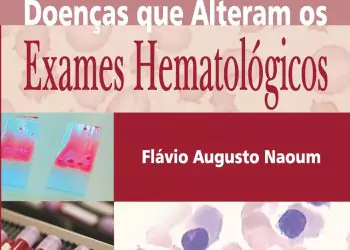 Doenças que alteram os exames hematológicos (Naoum) - 2. ed. PDF