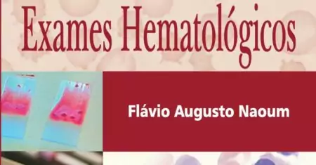 Doenças que alteram os exames hematológicos (Naoum) – 2. ed. PDF