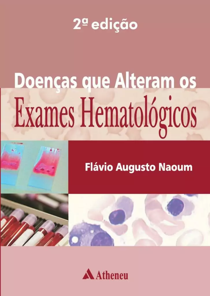 Doenças que alteram os exames hematológicos (Naoum) – 2. ed. PDF